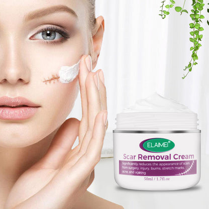 Crema acné Sin Cicatrices – Crema para Eliminar Cicatrices – Crema Facial – Crema para Cicatrices de Acné en el Rostro – Estrías – Crema Reparadora de la Piel para el Rostro
