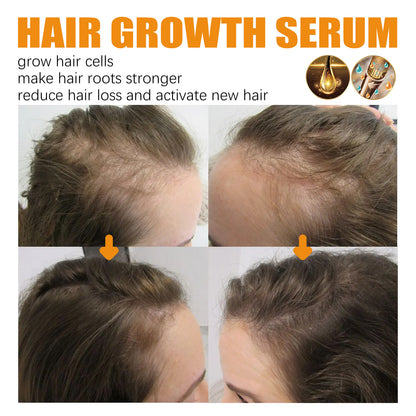 Aceite Esencial para el Crecimiento y Reparación del Cabello