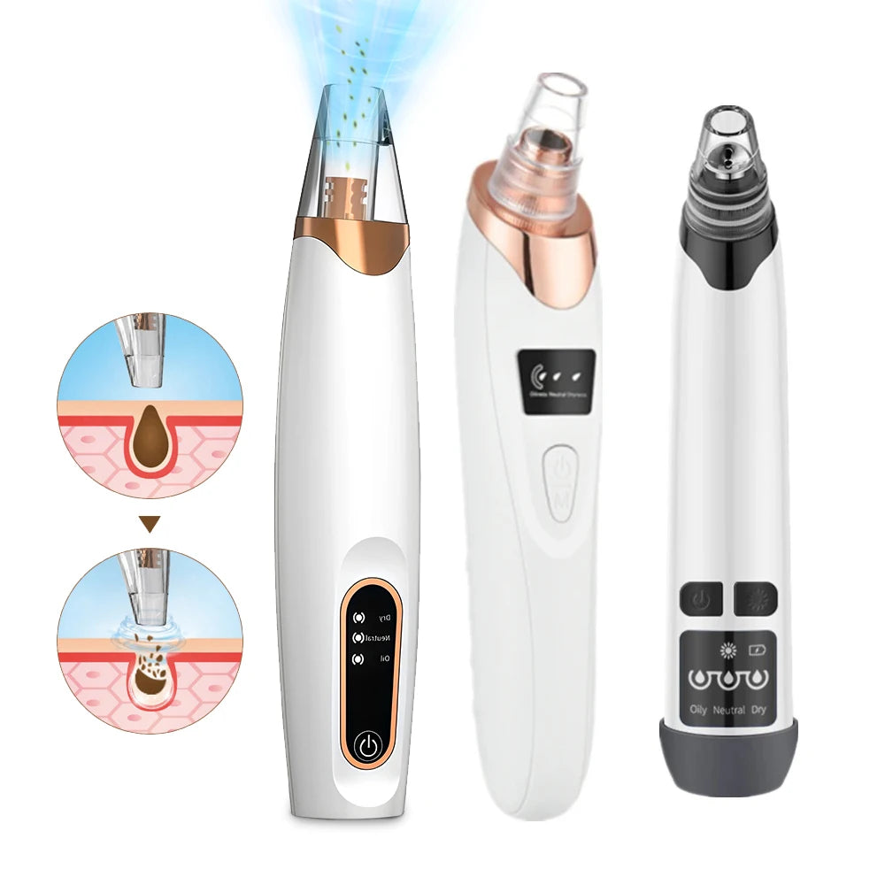 Electric Blackhead Remover Beauty Facial Cleaner Black Point Vacuum Suction Black Head Dots Remover Extractor Skin Care Tools