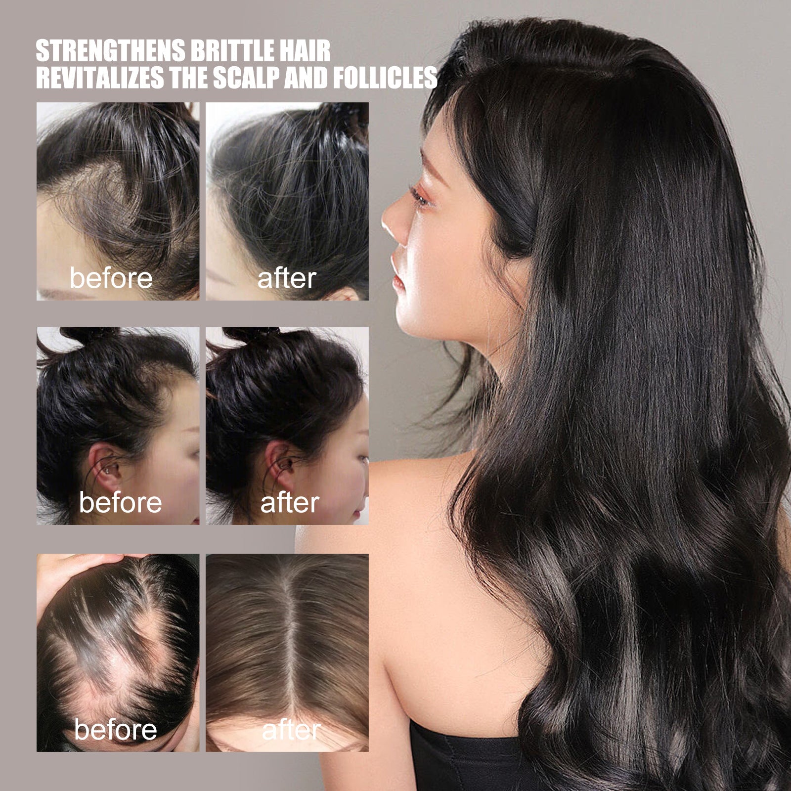 Aceite Esencial para el Crecimiento y Reparación del Cabello